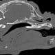 CT scan of brachycephalic dog skull